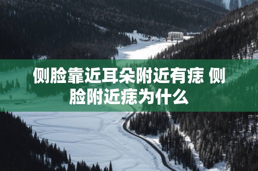 侧脸靠近耳朵附近有痣 侧脸附近痣为什么