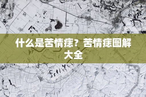 什么是苦情痣？苦情痣图解大全