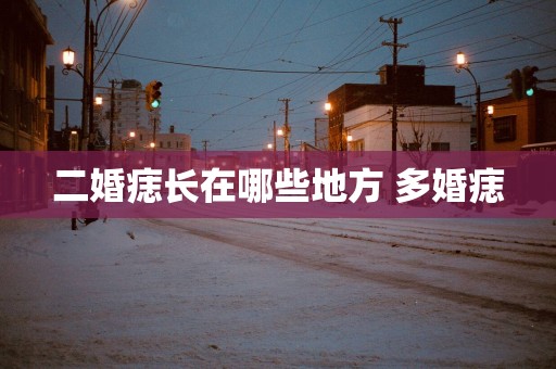 二婚痣长在哪些地方 多婚痣