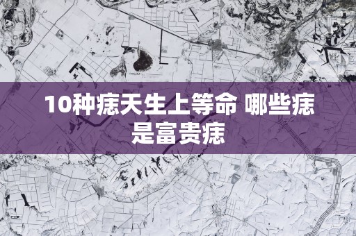 10种痣天生上等命 哪些痣是富贵痣