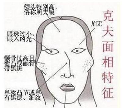 3种克夫相女人不能娶 克夫的女人面相有什么特征