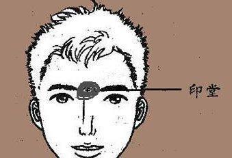 为什么说印堂饱满的人命好 印堂发黑会怎么样