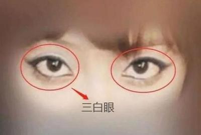 三白眼和四白眼面相是什么样子你知道吗