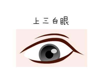 三白眼是什么样子的 三白眼面相有哪些特征