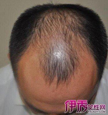 做梦梦见女人自己的头发长了是什么意思