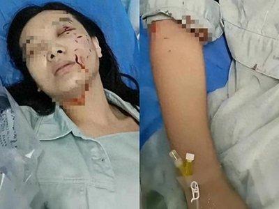 你脸上有没疤痕  脸上疤痕对你命运有什么影响_