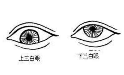 下三白眼的人面相如何 拥有下三白眼是好还是不好