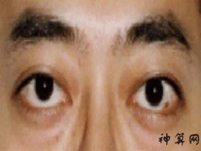 下三白眼的男人的命运解析 男人下三白眼好吗