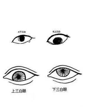 下三白眼睛是好是坏 生有下三白眼的人会有好命吗