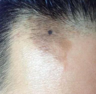 从女生额头看出的性格特征 看女生额头知道性格好坏