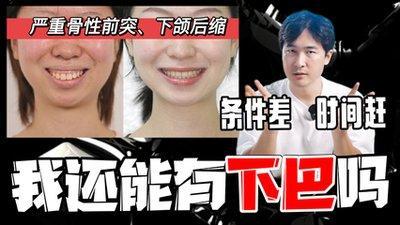 下巴前突的人性格怎么样  下巴前突的人脾气大吗