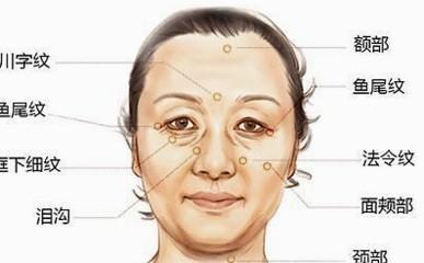 从法令纹看女性的命运 长有法令纹的女人运势如何