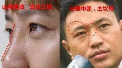 从面相学来看山根代表什么 山根低的人命运好吗