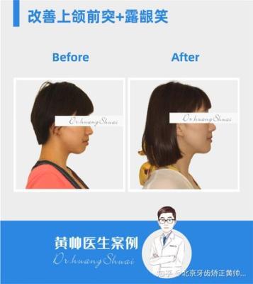 做梦梦见病人牙齿掉了又长出来是什么意思