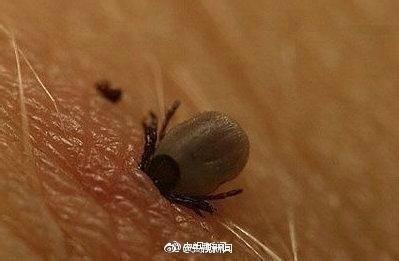 做梦梦见病人自己身上长虫子是什么意思