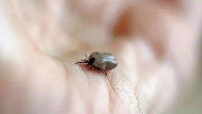 做梦梦见病人自己身上长虫子是什么意思