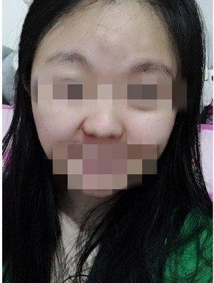 关于印堂凹陷面相的女人你知道运势吗