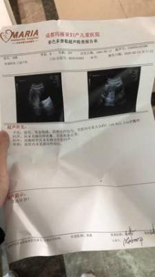 做梦梦见自己在梦中动不了,跑起来也无力