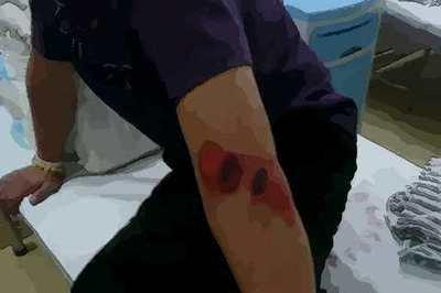 做梦梦见自己手臂流血不止是吉是凶