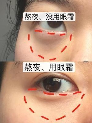 卧蚕眼代表什么呢 长有卧蚕眼好不好