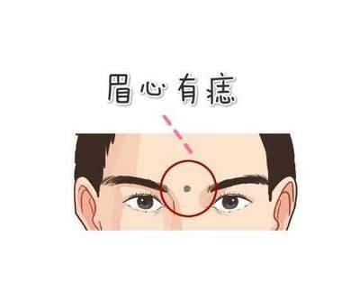印堂上长痣的人命运怎么样 印堂长痣好不好
