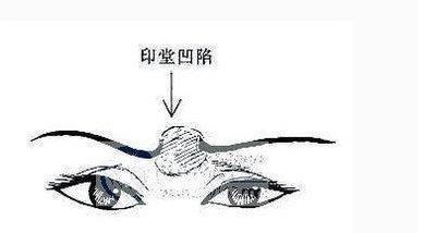 印堂凹陷是什么预兆 印堂凹陷的人命运是好还是坏