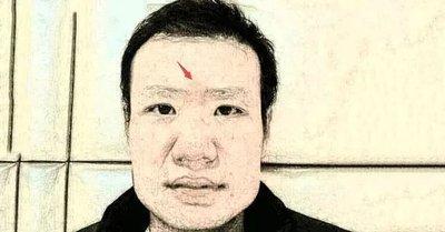 印堂凹陷的人事业真的曲折吗 看印堂了解命运