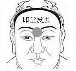 印堂凹陷面相解析 印堂凹陷有哪些影响