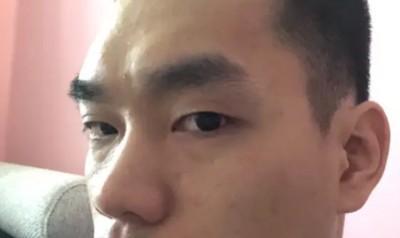 印堂发黑对命运有何影响 印堂发黑的人命好吗