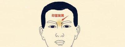 印堂发黑必有大凶 印堂发黑真的不好吗