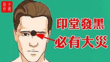 印堂发黑是什么原因 面相印堂发黑好吗