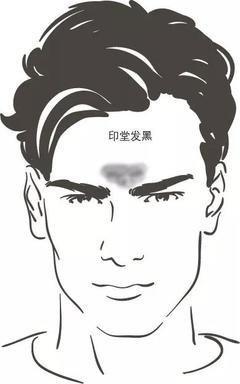 印堂发黑是什么原因 面相印堂发黑好吗