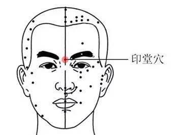 印堂发黑是怎么回事 为什么会印堂发黑