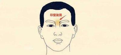印堂发黑的人怎么回事 印堂发黑的人命运好吗