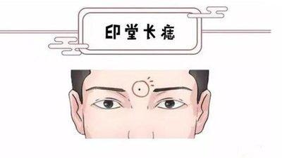 印堂有痣代表什么 印堂长痣是好还是不好
