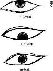 告诉你什么是四白眼 四白眼面相解析