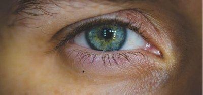 告诉你穷痣长在哪这些的人一生都很贫穷