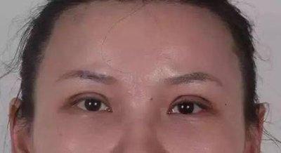 半截眉毛的女人命短吗 女人只有半截眉毛代表什么