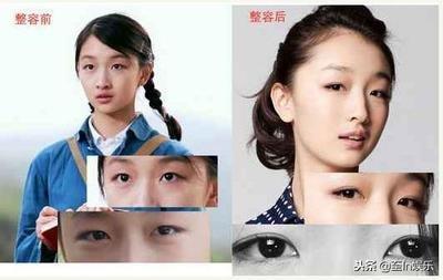 单眼皮面相的三种特征 单眼皮的人特点有什么
