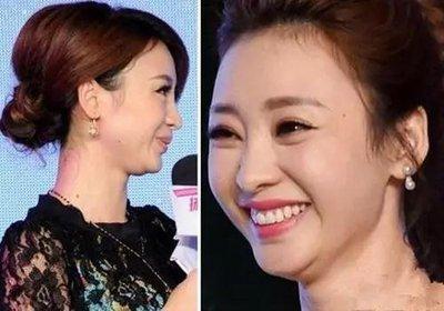 双下巴命运如何 双下巴的女人好不好