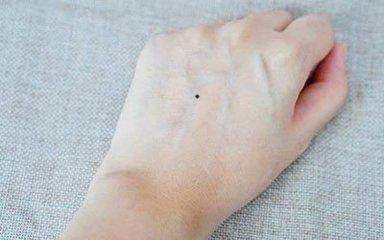 女孩手背长痣好不好 手背长痣的女人命运如何