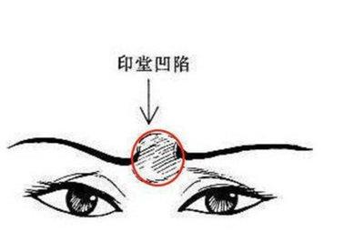 女人印堂凹陷的面相解析 女人印堂凹陷好不好