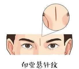 女人印堂有悬针纹好不好 印堂有悬针纹说明了什么