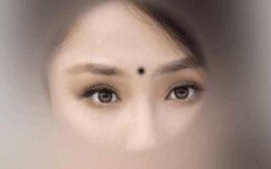 女人印堂有疤痕面相 印堂有疤痕有什么影响