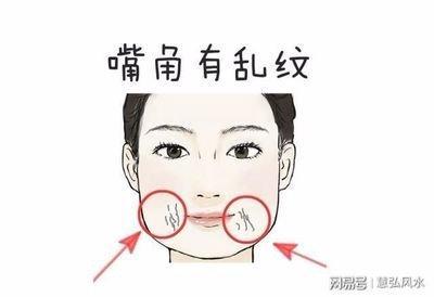 女人印堂有痣命运如何 分析印堂有痣女人的一生