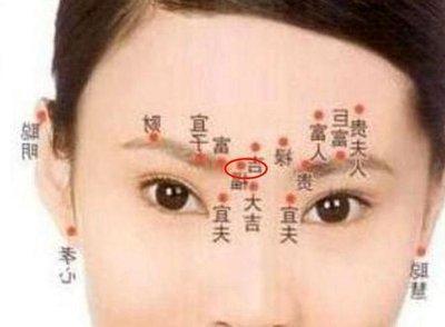 女人印堂有痣命运如何 分析印堂有痣女人的一生