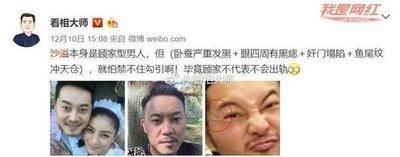 四白眼的男人面相 男人有四白眼好不好
