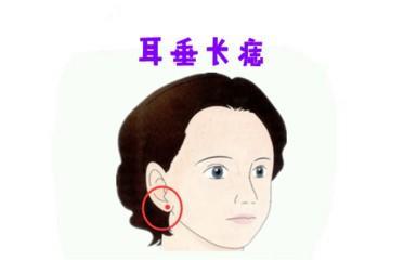 四种旺夫又有财的痣相 这些地方有痣旺夫