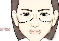 女人命不好的面相，女人不好的面相特征