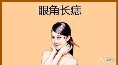 女人哪些痣能必须嫁富商 这些地方长痣的女人嫁有钱人